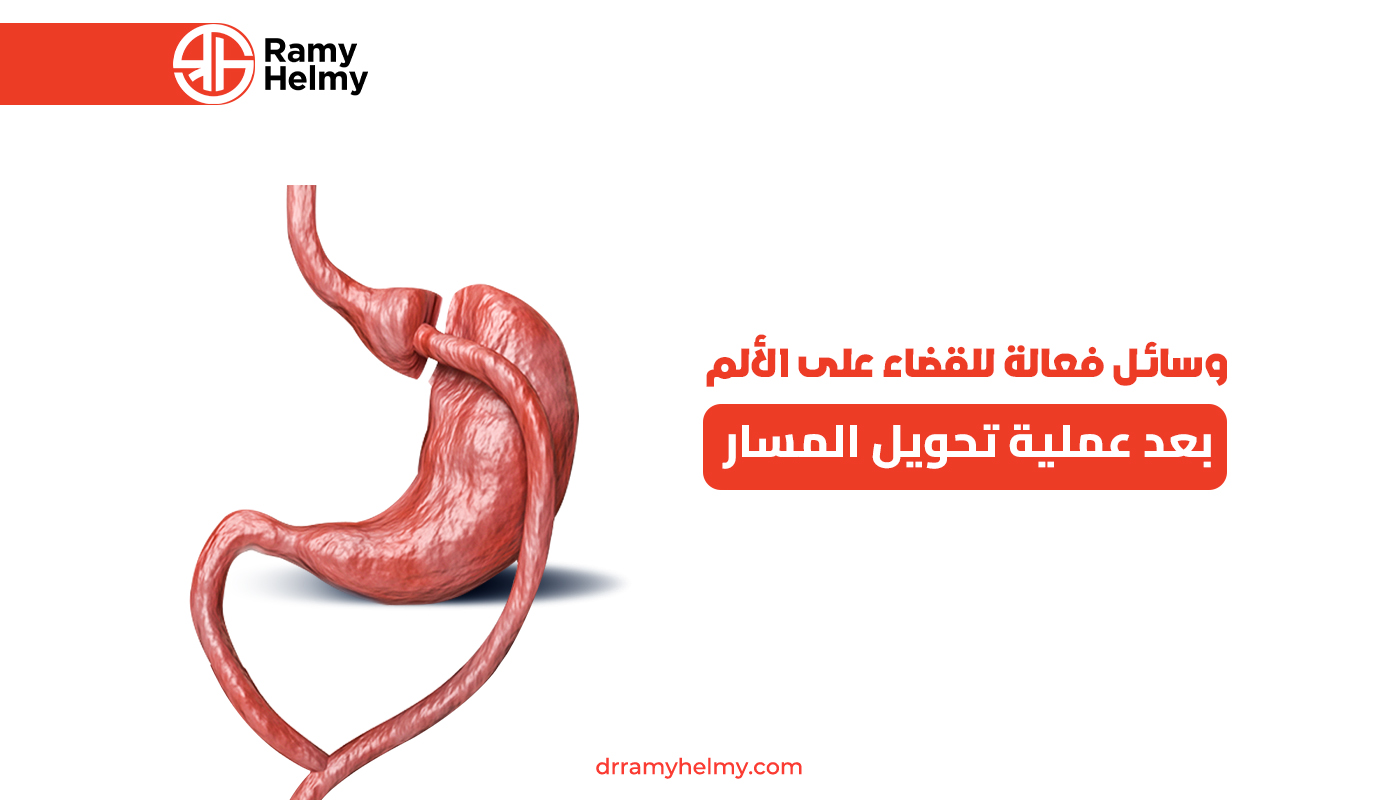 الألم بعد عملية تحويل المسار