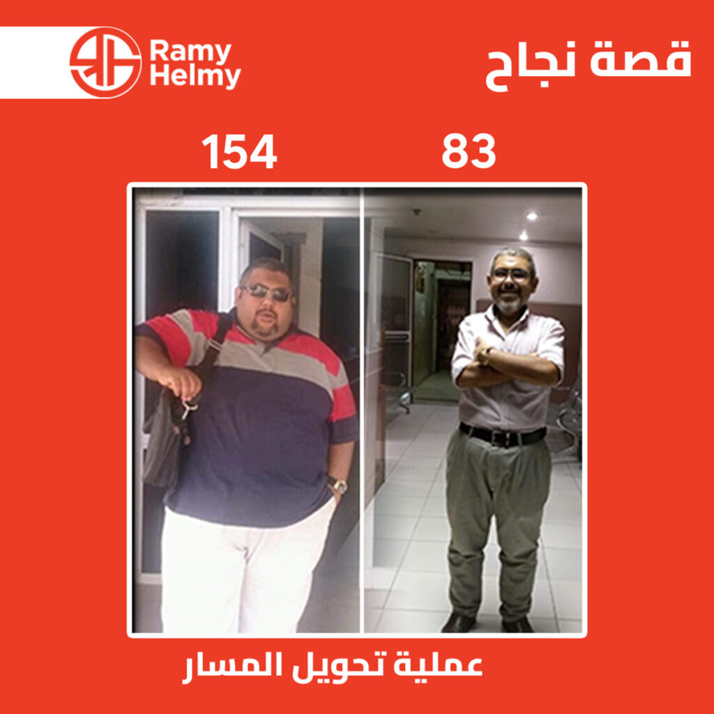 من نتائج عملية تحويل المسار مع دكتور رامي حلمي