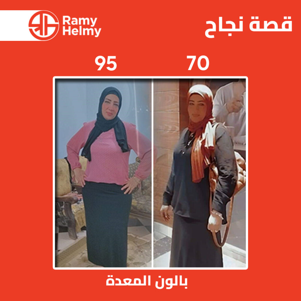 نتائج بالون المعدة مع دكتور رامي حلمي