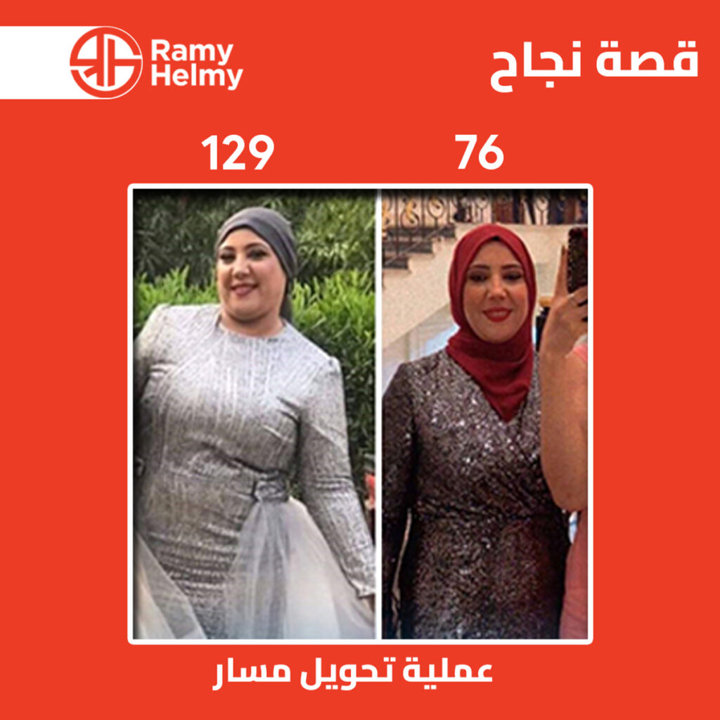 من نتائج عملية تحويل المسار مع دكتور رامي حلمي