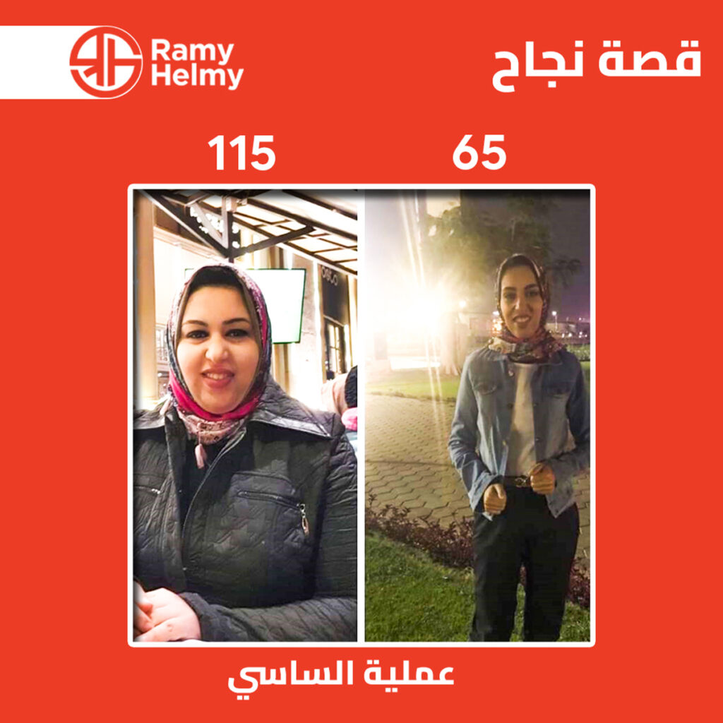 من نتائج عملية ساسي للتخسيس مع الدكتور ارمي حلمي