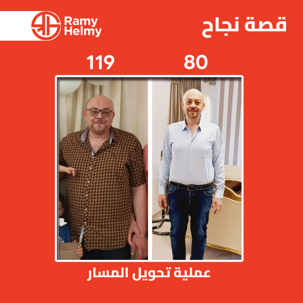 من نتائج عماية تحويل المسار مع الدكتور رامي حلمي