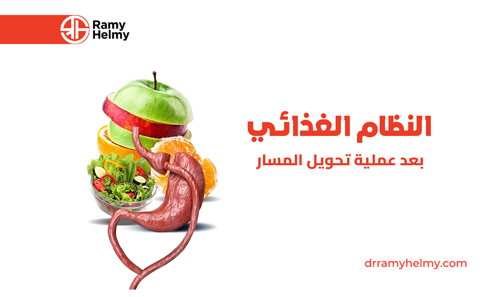 النظام الغذائي بعد عملية تحويل المسار