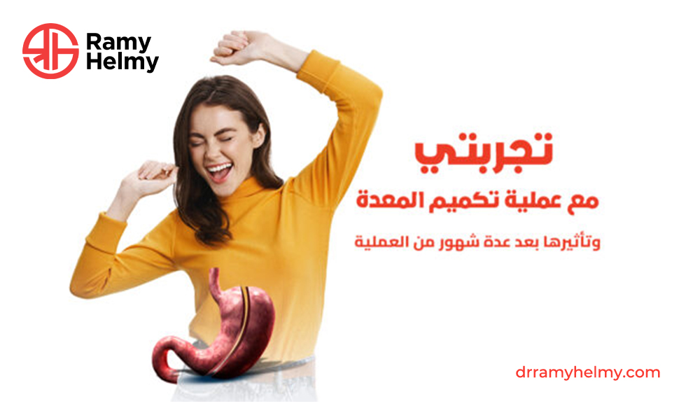 تجربتي مع عملية تكميم المعدة