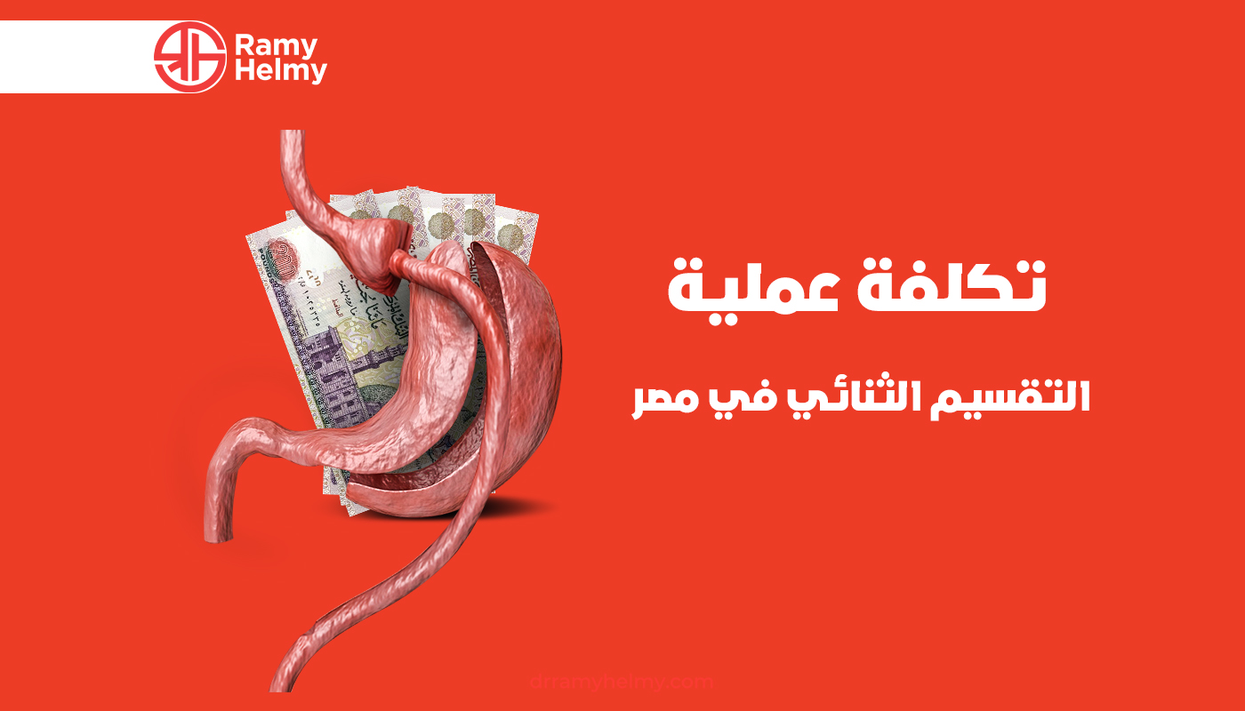 تكلفة عملية التقسيم الثنائي