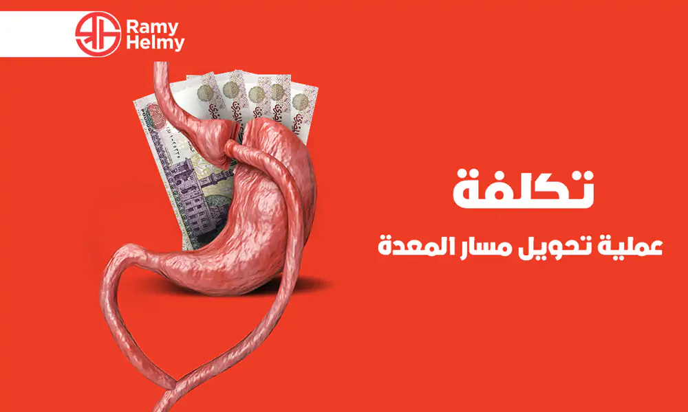 تكلفة عملية تحويل مسار المعدة