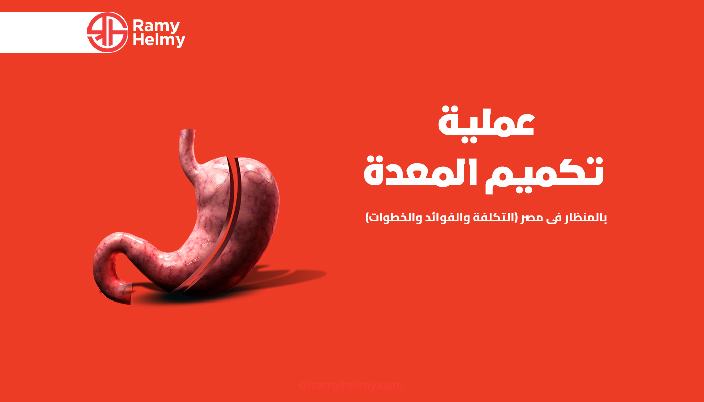 تكميم المعدة بالمنظار