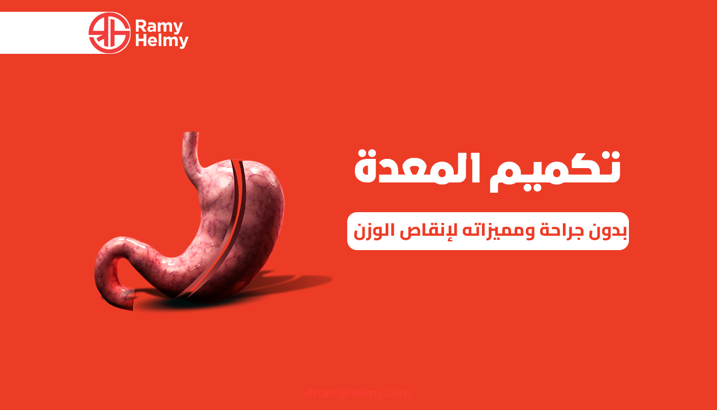 تكميم المعدة بدون جراحة
