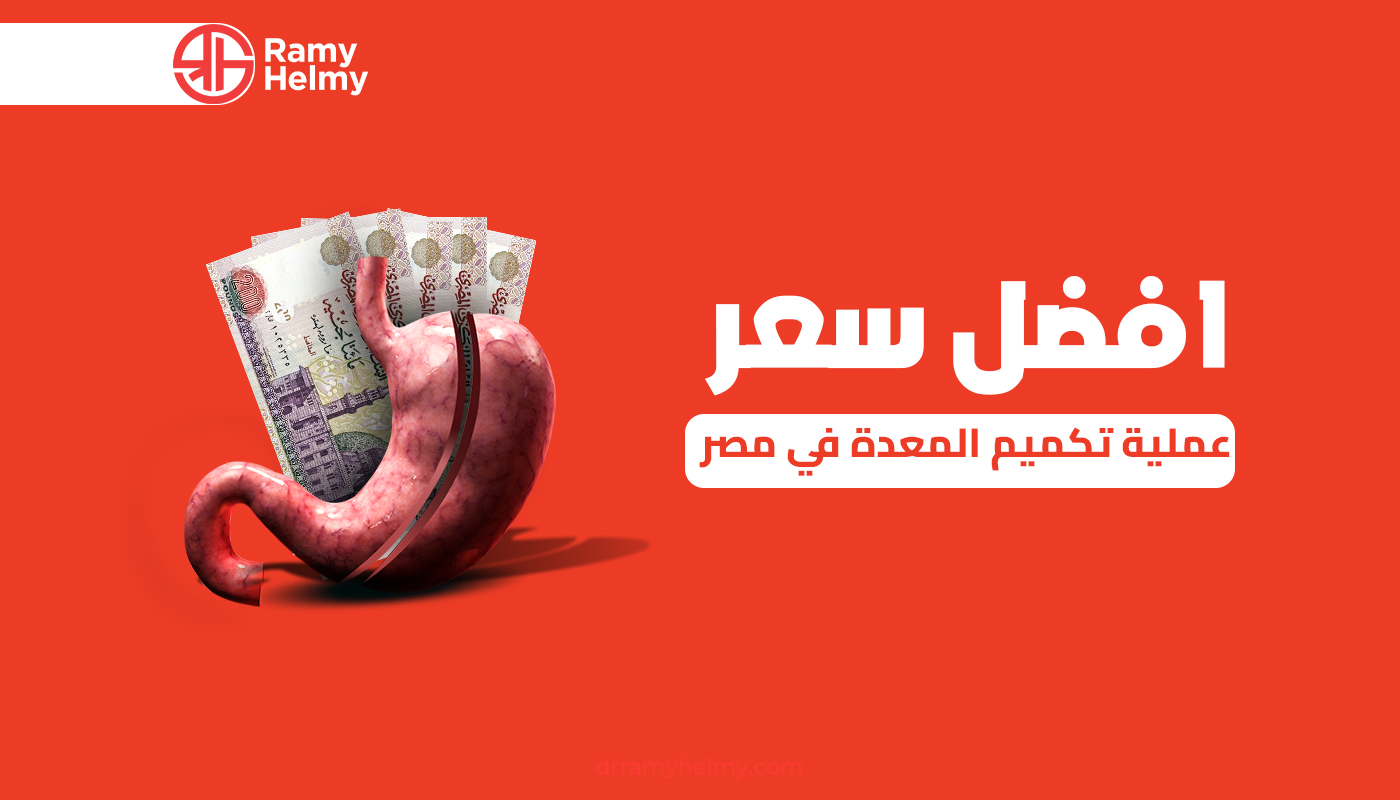 سعر عملية تكميم المعدة في مصر
