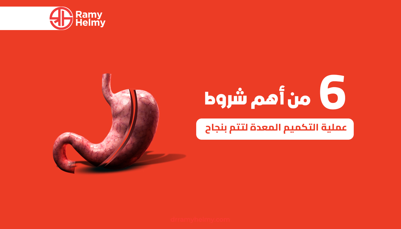 شروط عملية التكميم