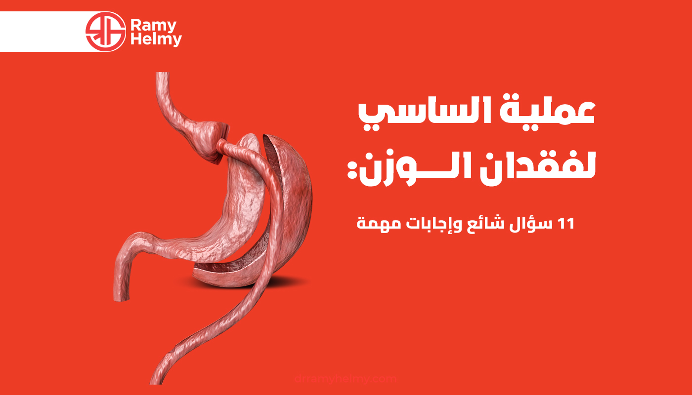 عملية الساسي
