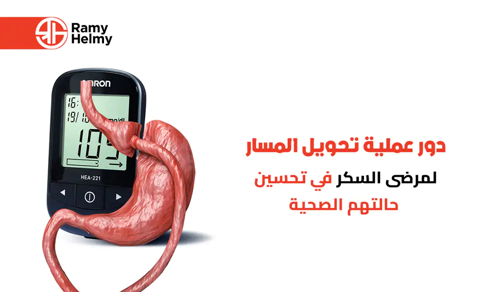 عملية تحويل المسار لمرضى السكر