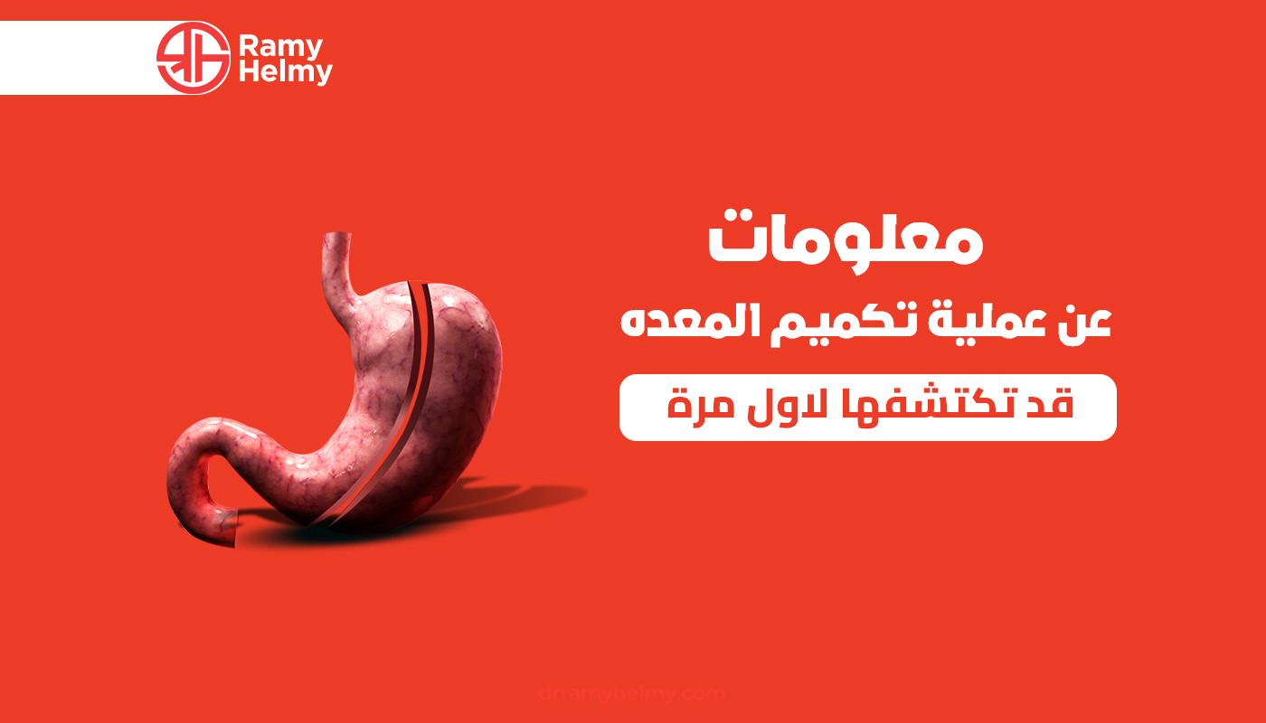 معلومات عن عملية تكميم المعده