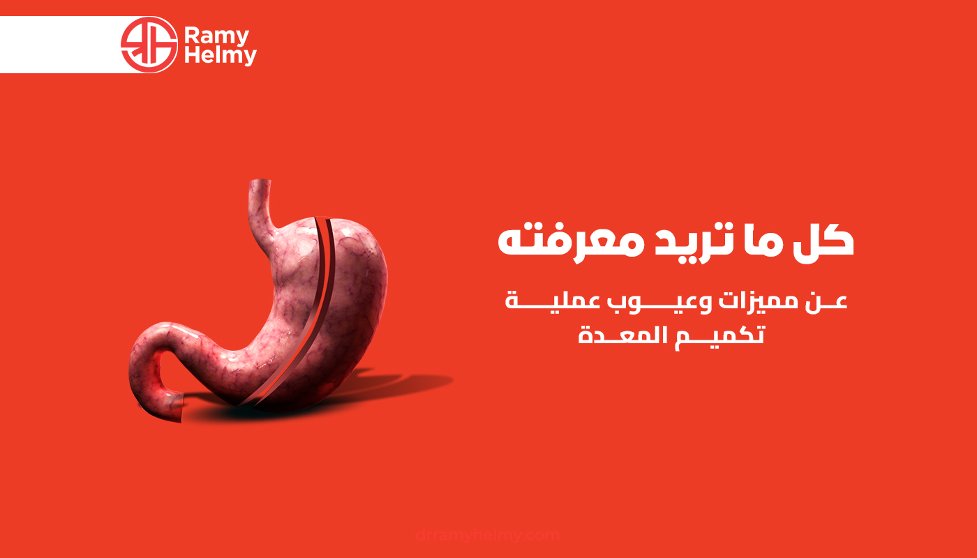 مميزات وعيوب عملية تكميم المعدة