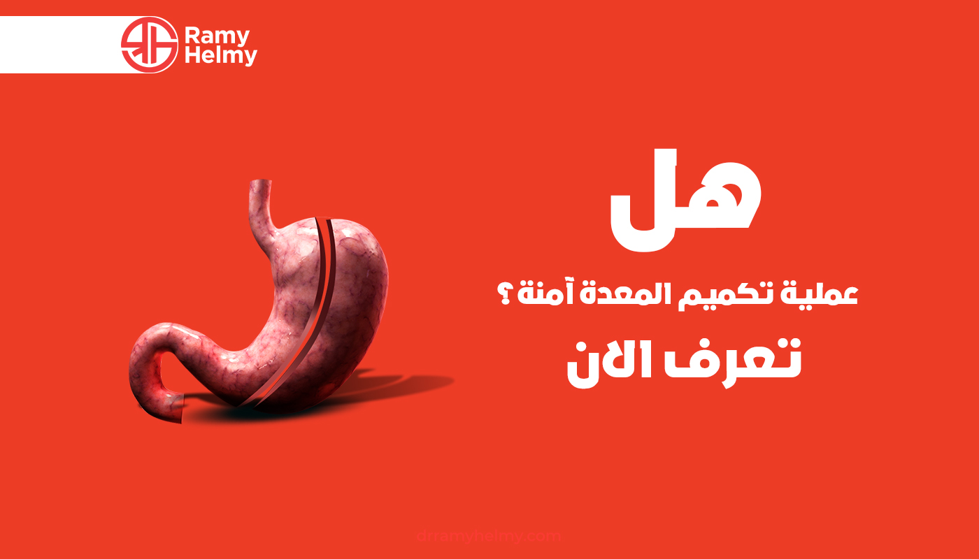 هل عملية تكميم المعدة آمنة