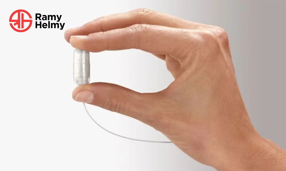 كبسولة المعدة