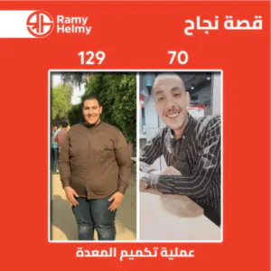 تجربتي بعد شهرين من التكميم