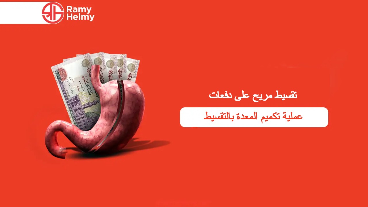 عملية تكميم المعدة بالتقسيط
